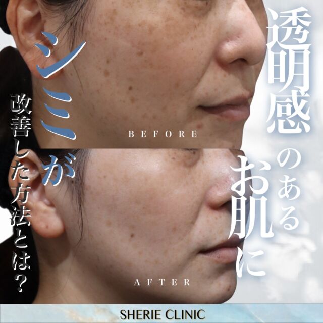 SHERIE CLINIC （シェリークリニック）福岡院 |