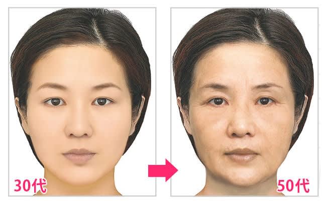 男性が老けて見える原因は？フェイスリフトで若見えを実現 - 渋谷の美容外科・美容整形クリニック |