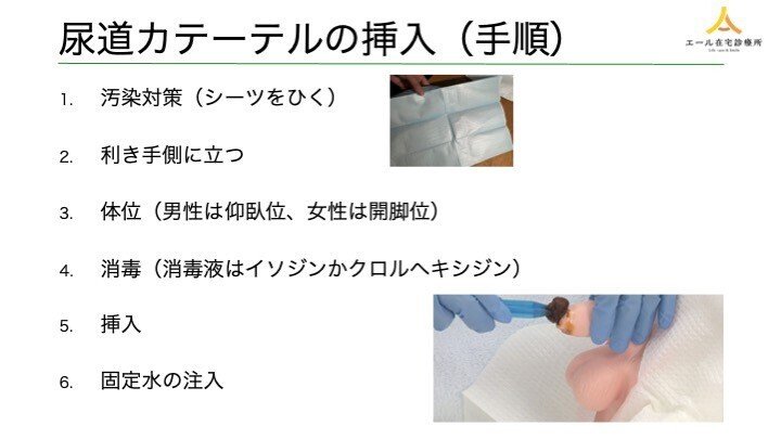 ガイドラインに基づいた前立腺肥大症の正しい知識と治し方 | 同友会メディカルニュース