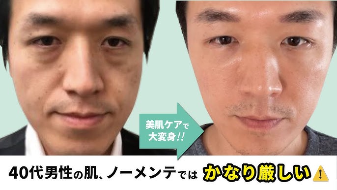 40代老化】男性が気になるシワは口もとより目もとだった！効率的シワケアの真実 | 老化の予習