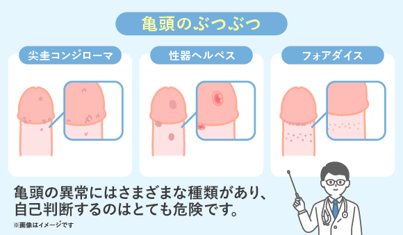 千秋ちんこの脳内イメージ - 脳内メーカー