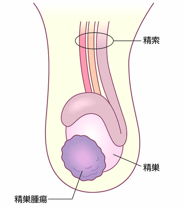 前立腺炎 (ぜんりつせんえん)とは | 済生会