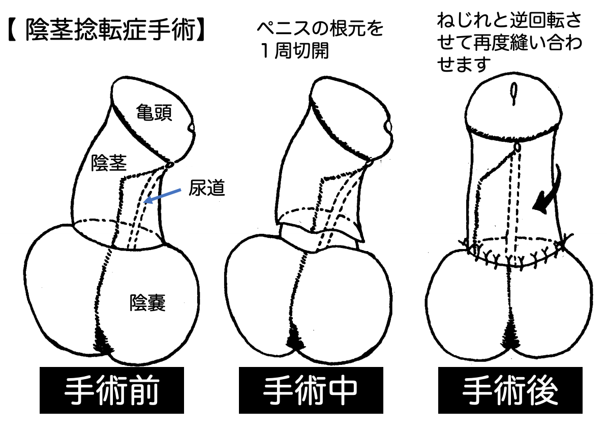 巨チンだけどパンティ穿きたい（有閑high桜）の通販・購入はメロンブックス | メロンブックス