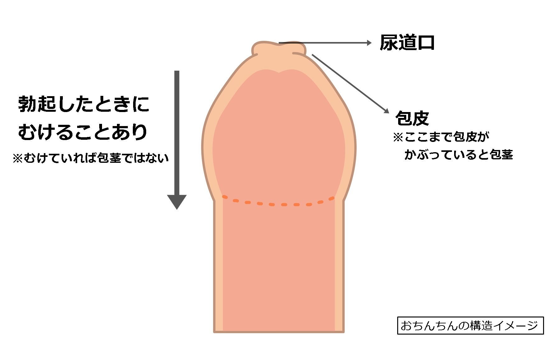 長茎手術 | エーツークリニック