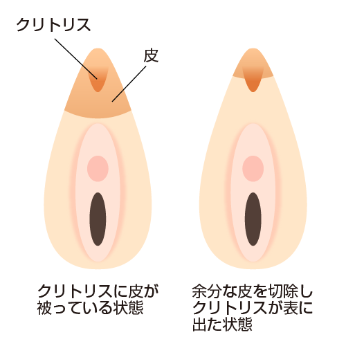 ペニスとクリトリス「勃起・形・メカニズム」の違い【比較完全図解】 | セクテクサイト