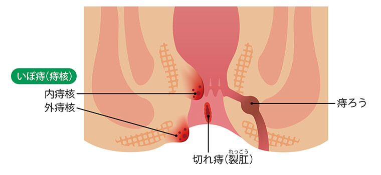 ところで, なんであかぎれにオロナイン？, と、ふと思ったことのあるみなさんに、, この機会にお伝えしたい！オロナインの理由。, 