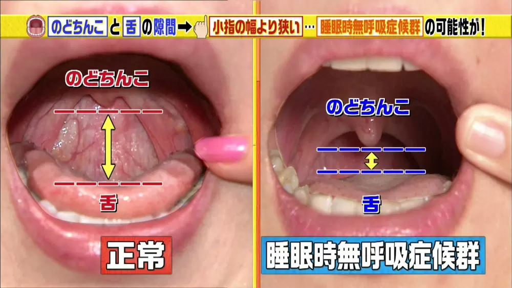 喉ちんこの正式名称＆出来方・・・？？？ 意外なことが・・・！！！: いつまでも元気でいたい岩元