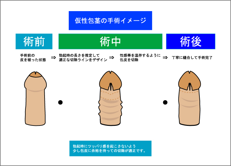 楽天市場】【公式正規品】 MUKETE（ ムケテ ）