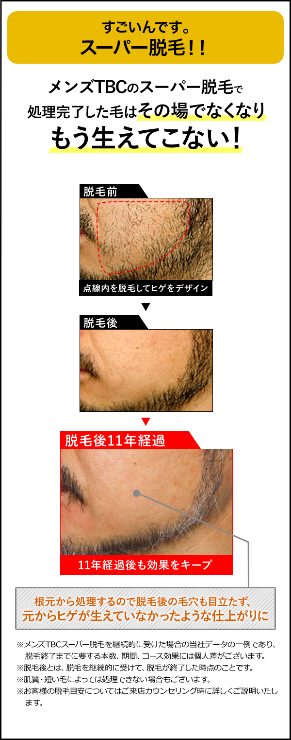 エステティックTBCの脱毛の口コミや評判を調査！効果や気になる料金など