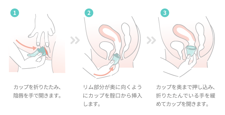 月経カップの使い方｜スマルナ