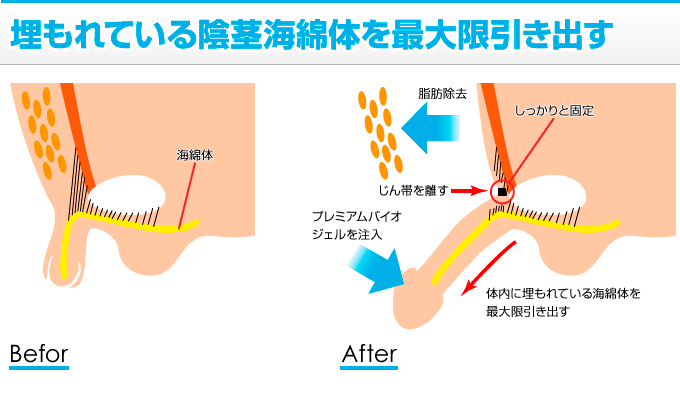 男性器の大きさについて｜大東製薬工業株式会社