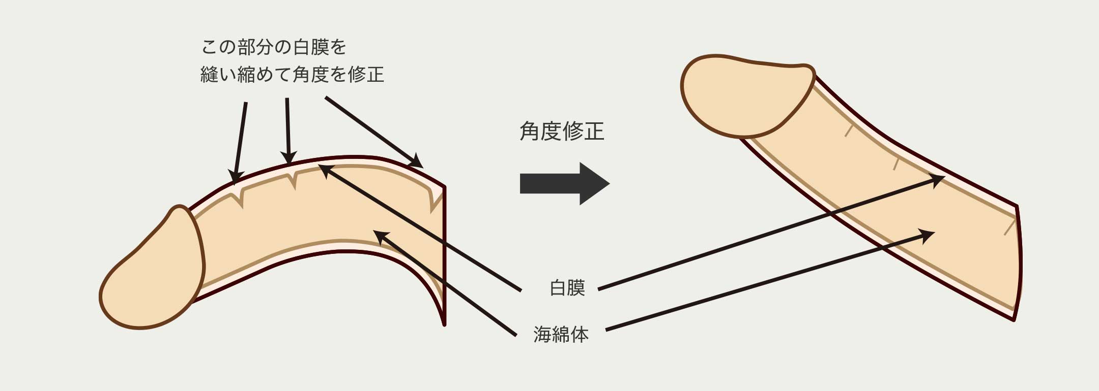 症例27 小帯について (動画有り) | 山本クリニック｜鳥取県米子市