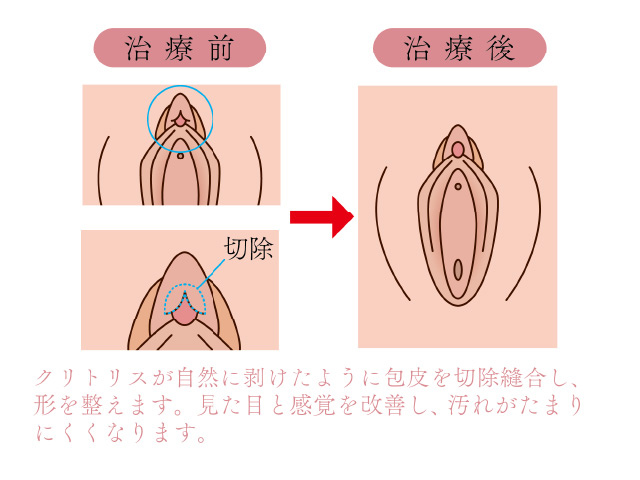 クリトリスの触り方！クリ愛撫でのいじり方 - 夜の保健室