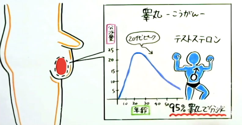 精巣捻転（睾丸捻転）｜すこやかコラム｜ときわ会グループ