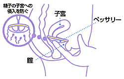 避妊法について | 金山レディースクリニック