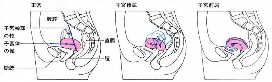 ぷにっとりあるサック 上反りＢＩＧ - ペニスサック通販｜大人のおもちゃ通販大魔王