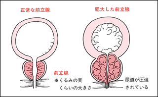 浴室で自慰行為をしたいんですが、排水口カバーとヘアキャッチャーを外- 電気・ガス・水道 | 教えて!goo