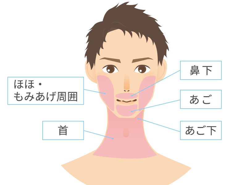 湘南美容クリニックのヒゲ脱毛は効果ない？6回コースの効果や口コミ評判を調査 | ExecuIT