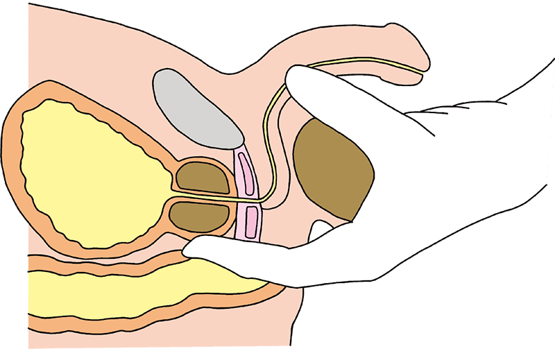 前立腺マッサージとは？｜大阪回春性感エステ｜大阪のえっちなマッサージ屋さん