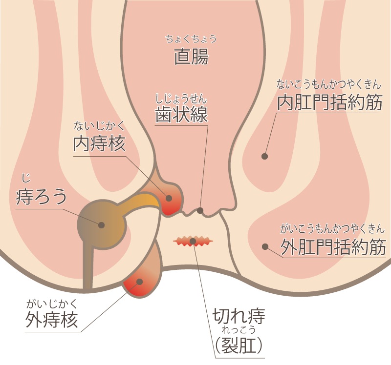 大阪府、鼠径ヘルニアのクリニック・病院一覧｜ドクターズ・ファイル