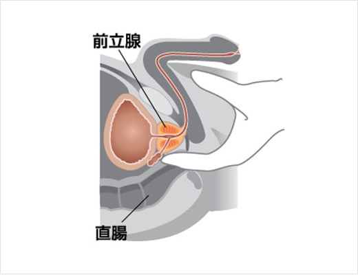 尿道狭窄症とは？｜尿道狭窄症・尿道形成術の医師堀口明男