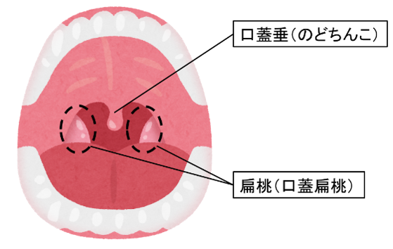 のどの奥に見える「のどちんこ」。これってなにか意味があるの？ | 山口県下関市の歯医者さん 加藤歯科医院
