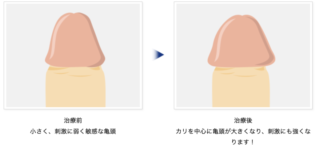 現役医師が解説】裏筋は性感帯じゃない！？ – メンズ形成外科 |