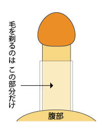 陰嚢水腫 | 執行クリニック／神楽坂D.S.マイクリニック