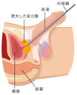 お客様の感想 | こうすけの前立腺マッサージ