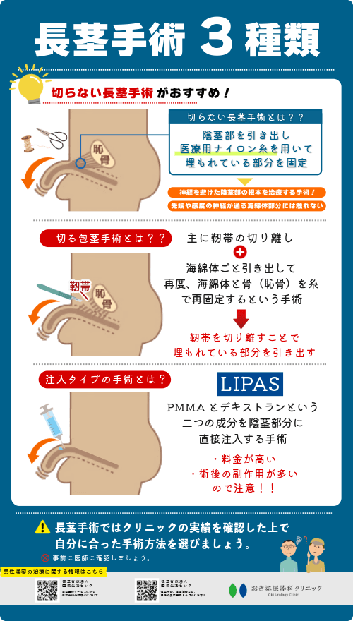 【１.５cm増】ちんちんを太くしたい人だけ見てください