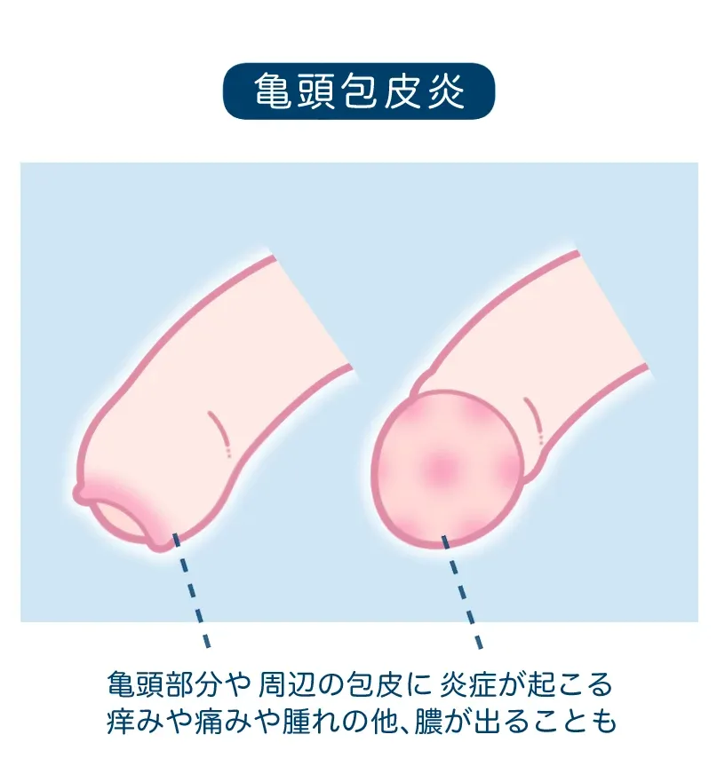 包茎男子がオナニーで満足するために気をつけるべき行為とは –メンズクリニック研究会-包茎