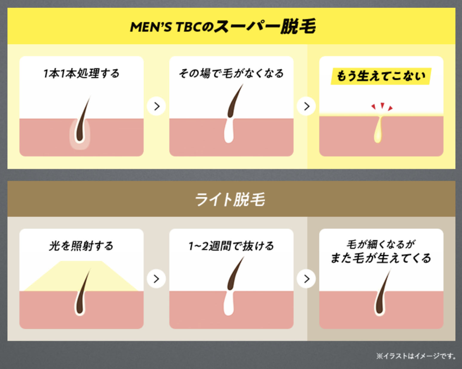 メンズTBCの脱毛の口コミ・評判は？料金やキャンペーン情報などをご紹介 - 駅探PICKS脱毛