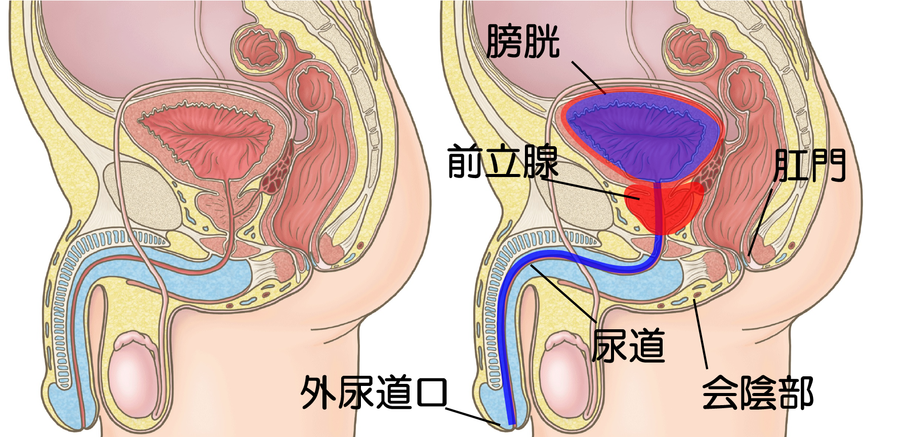 出血 ～不正出血～ －気になるからだの危険信号－ │ 生活習慣病を予防する