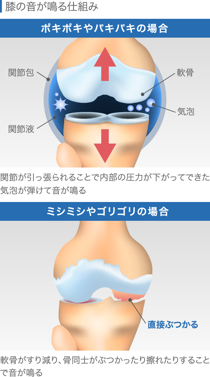 ひざの”カクン”を改善させるポイント | やまだ鍼灸整骨院