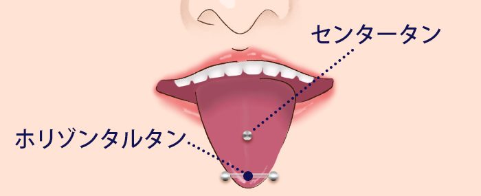 センタータン経過 | ピアス経過