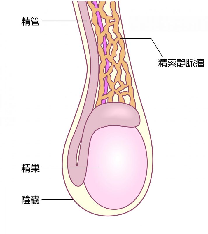 血精液症について（精液・精子に血液が混じる） | 東京泌尿器科クリニック上野