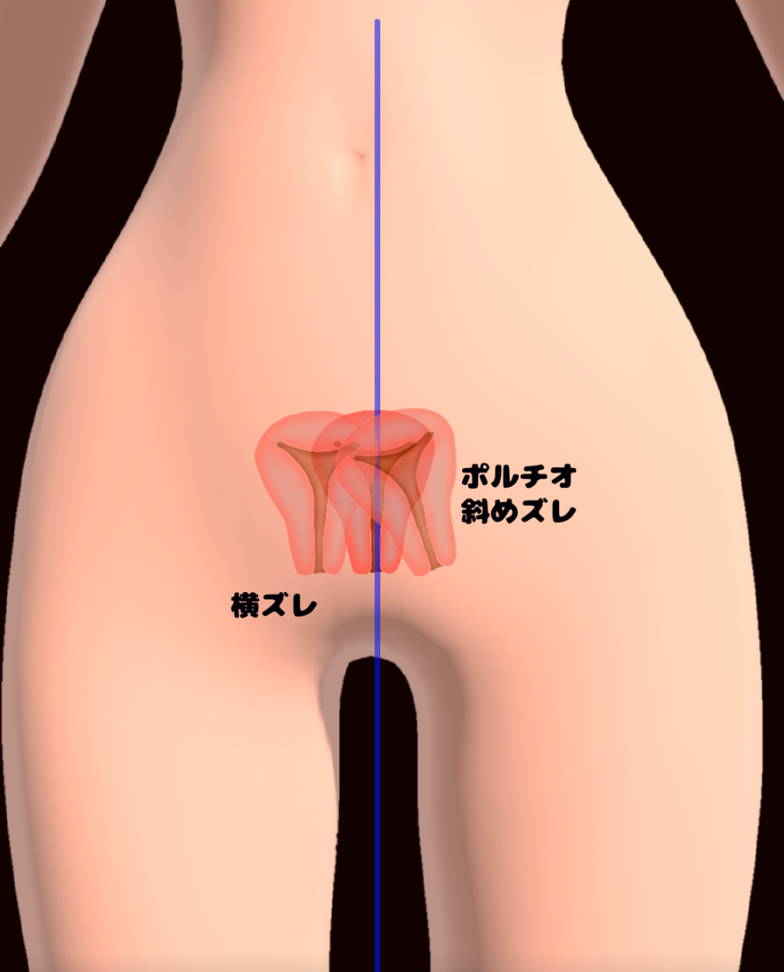 ポルチオとは？ 開発するとセックスが気持ちいい？ |