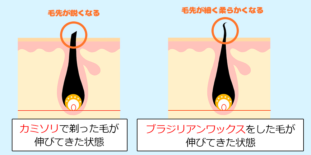 医師監修】「あごひげを抜くと生えてこない」は本当？デメリットや処理方法も解説 | Midashinami