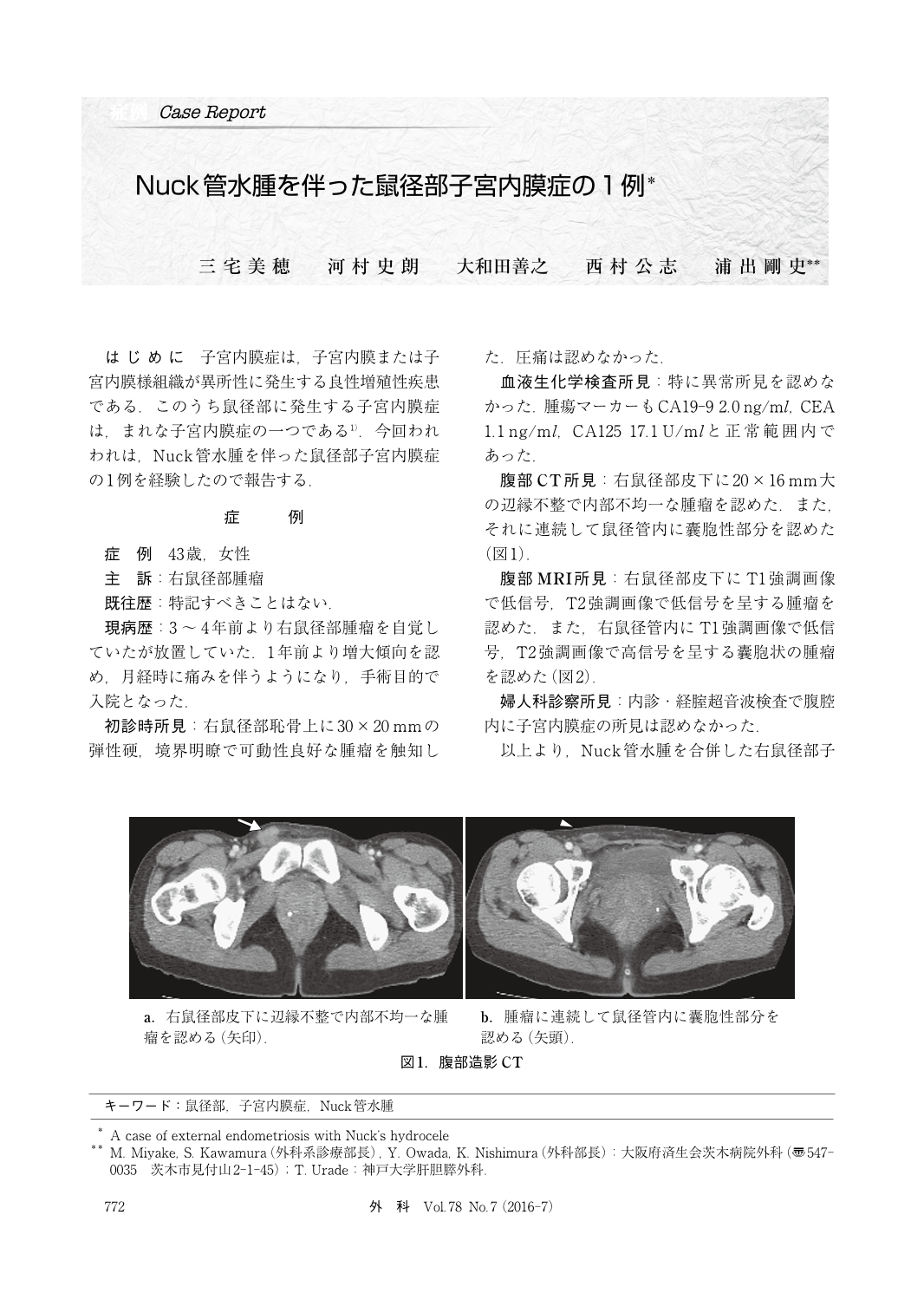 オイルリンパマッサージ 鼠径部 福岡 個室に関するエステサロン Neivs