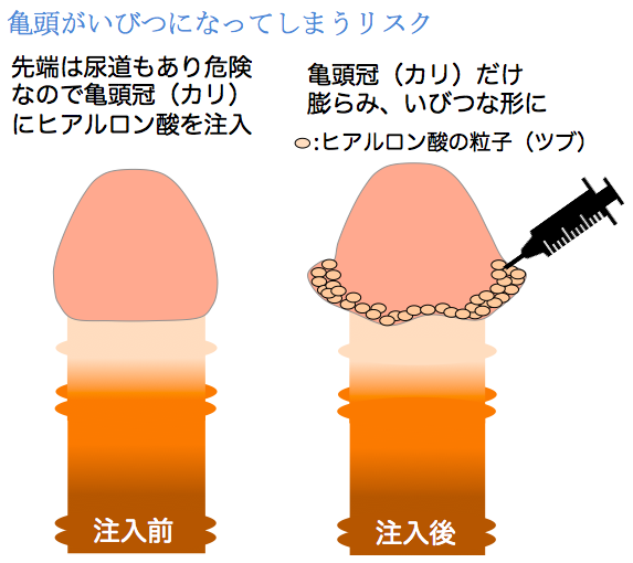 男性器の大きさについて -このペニスどうですか？ AVとか見る限り自分では- | OKWAVE