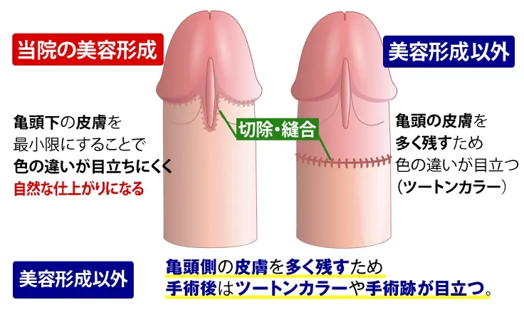 高品質 亀頭ゾリゾリ「連続のどちんこほーる」