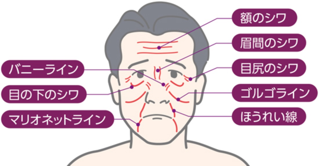 男性が老けて見える原因は？フェイスリフトで若見えを実現 - 渋谷の美容外科・美容整形クリニック |