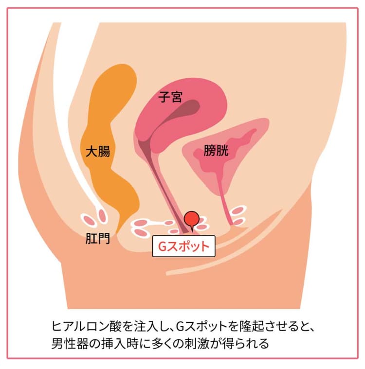 Gスポットはない人もいる!? 見つけ方と感じる方法を婦人科医がレクチャー｜GLITTER |