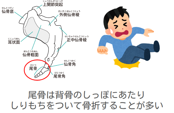 ストレッチ】仙腸関節とは？骨盤周辺の筋肉のバランスを整えて腰痛を予防しよう｜カラダケア研究所 | MEDIAID Online