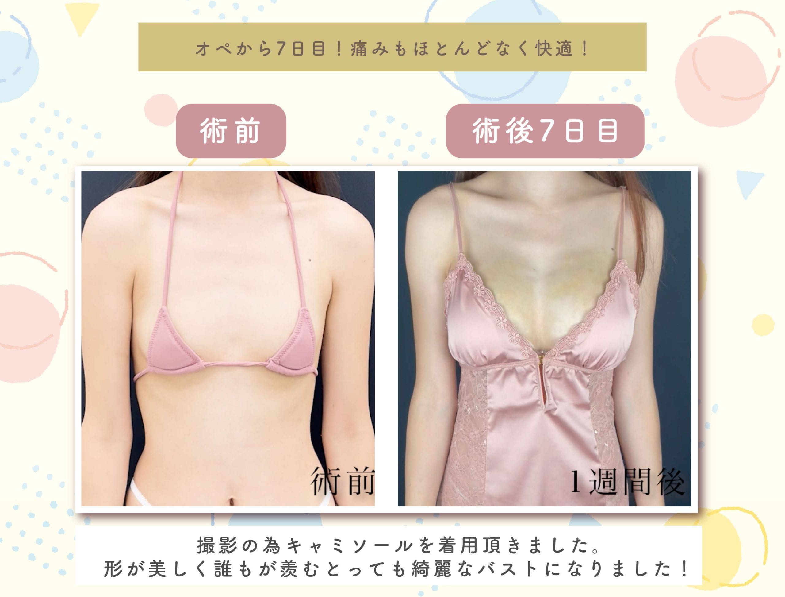 【毎日3分】胸だけ残して脂肪を燃やす胸部のダイエット