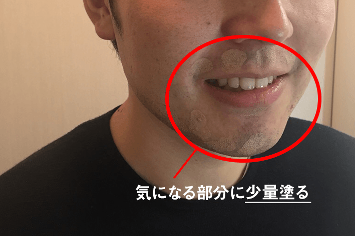 【閲覧注意】髭Wax脱毛で青髭無くせるんじゃない？