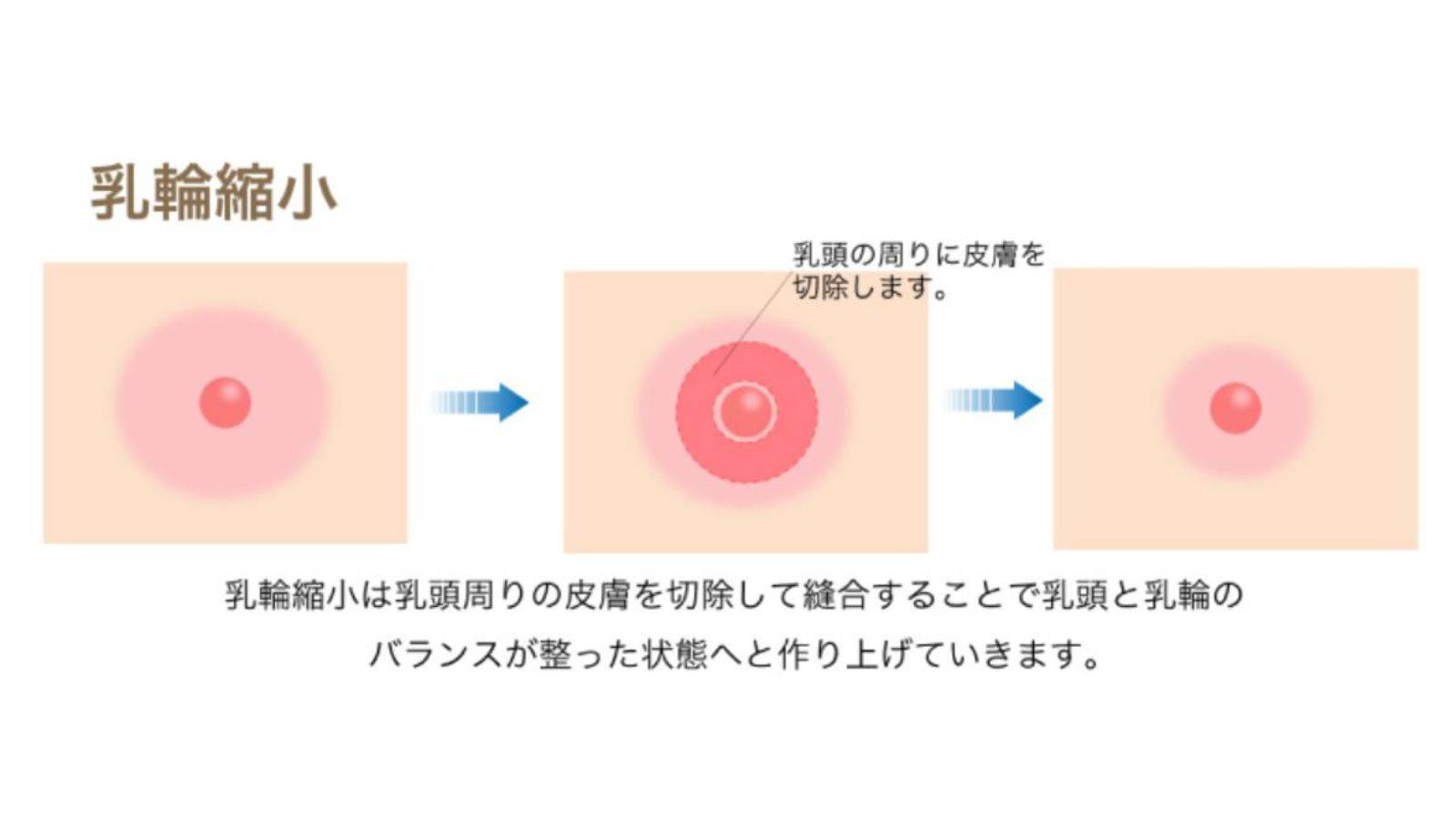 乳輪超デカそう | 写真で一言ボケて(bokete) -