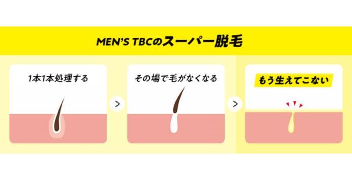 池袋で脱毛したい男性必見！池袋のおすすめメンズ脱毛クリニック・サロン - be freee