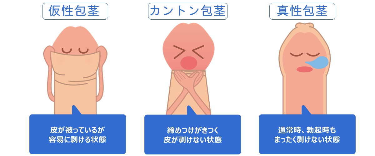 ペニスのサイズはどれくらい？TENGA社内で測ってみた - TENGAヘルスケア プロダクトサイト