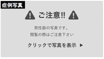 包茎手術後に注意すべきこととは？よくあるトラブルと対処法を解説 | 包茎手術のノーストクリニック【公式】